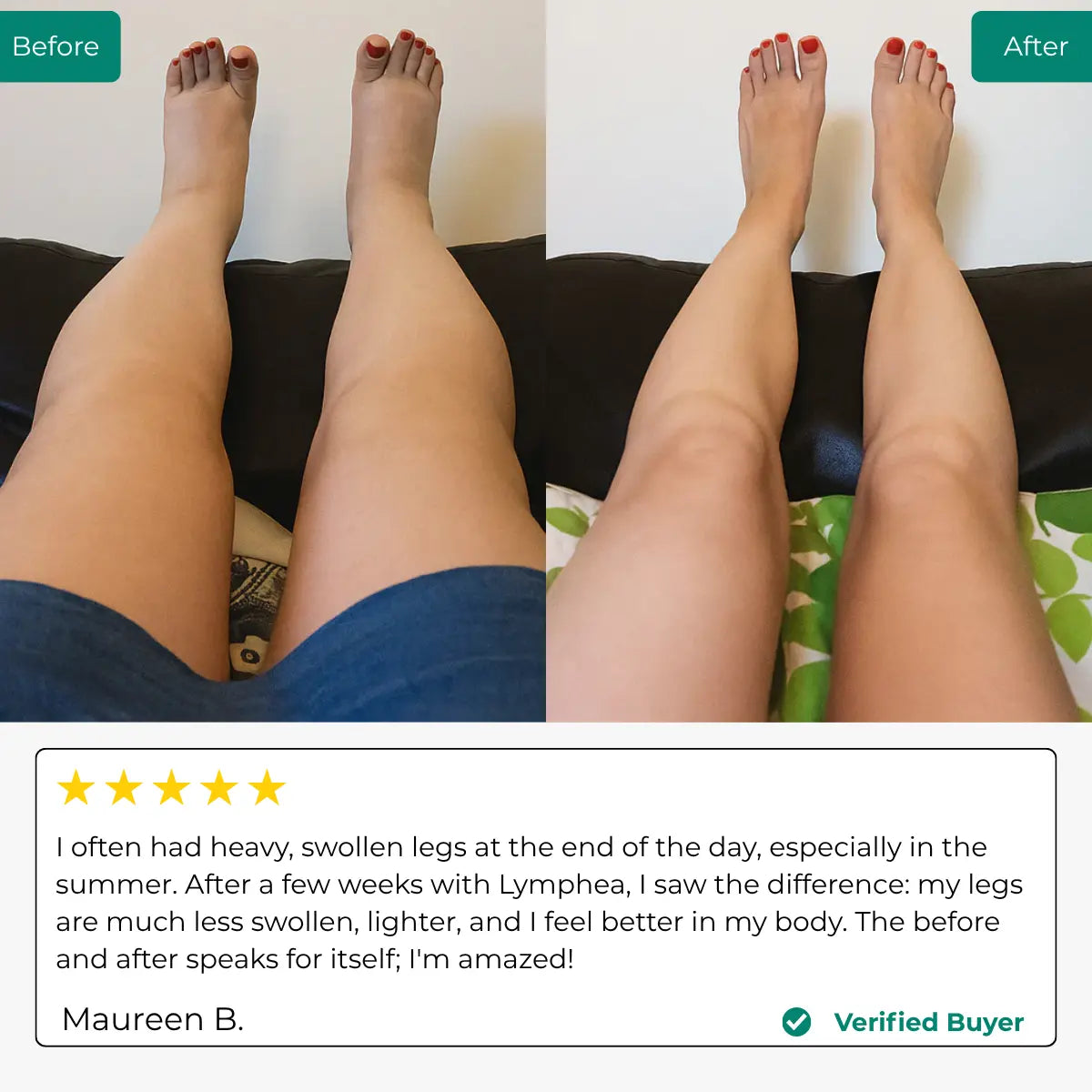 Lymphea | Lymphatic Drainage Supplement